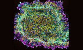 Rethinking Healthcare Productivity and the Strategic Role of Regenerative Medicine