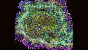 Rethinking Healthcare Productivity and the Strategic Role of Regenerative Medicine