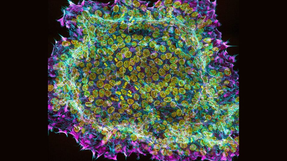 Rethinking Healthcare Productivity and the Strategic Role of Regenerative Medicine